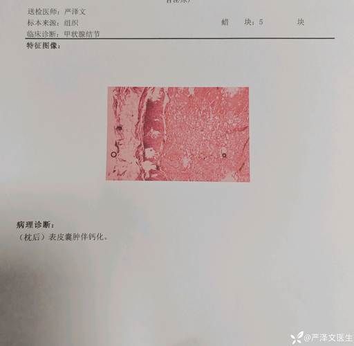 2022年8月15日扎囊县新增确诊病例情况_52457