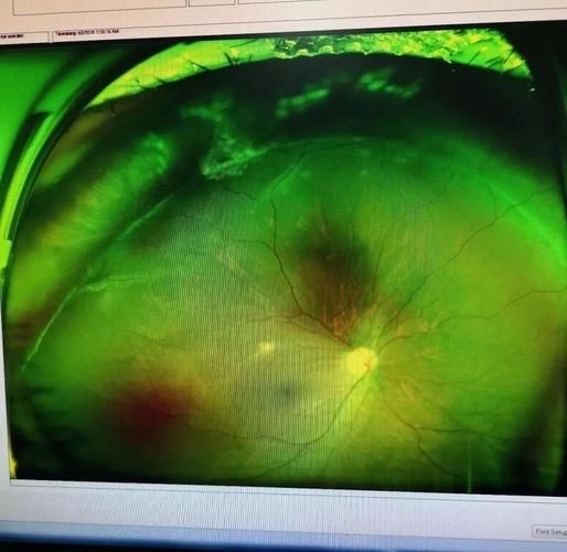 平远：粤东山区屏障下的低感染样本