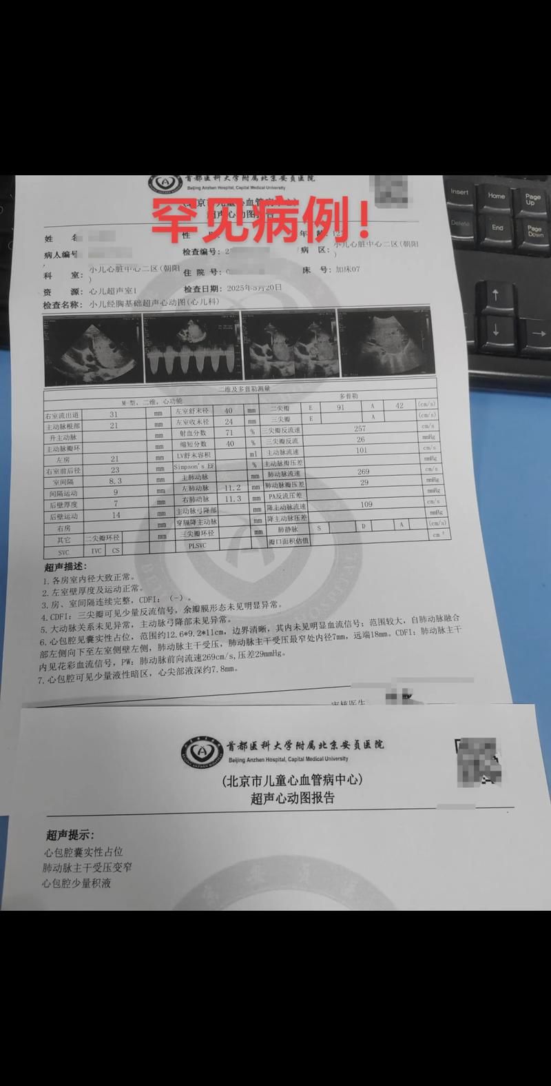 【2022年8月10日阿克塞新增确诊病例情况】