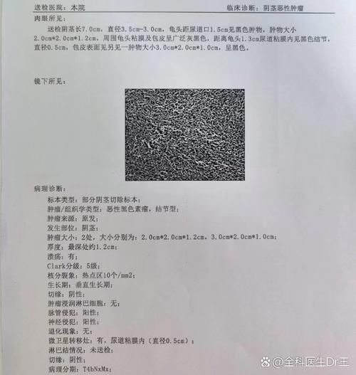 2022年1月15日获嘉新增确诊病例情况_81717