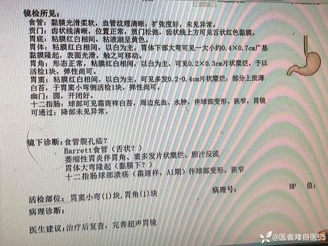 【2022年11月28日可克达拉新增确诊病例情况】