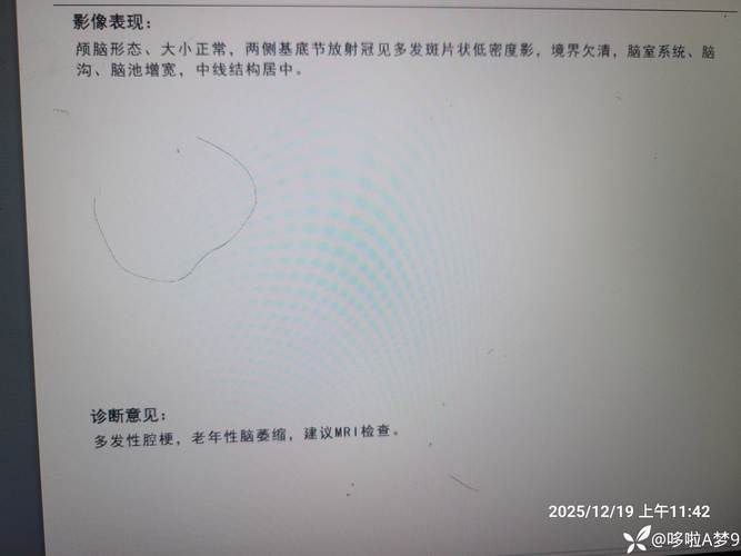 2022年4月4日寿县新增确诊病例情况_82347