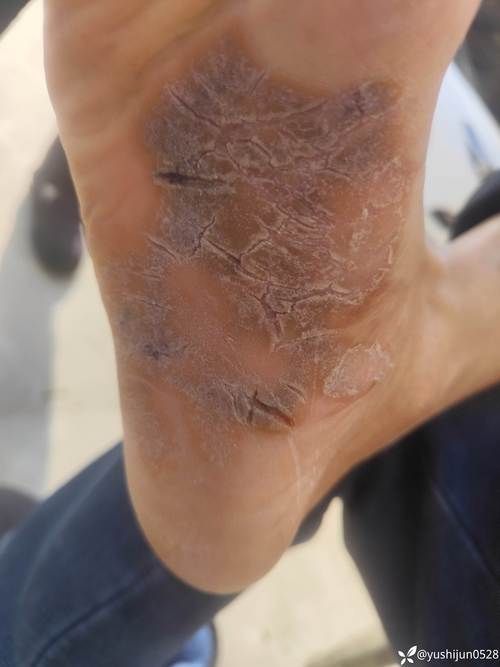 尼木：高原屏障下的零感染样本