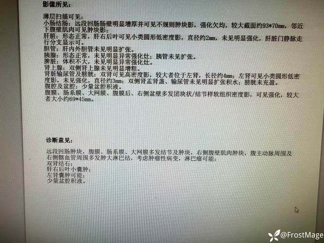 2022年9月30日自贡新增确诊病例情况_66930