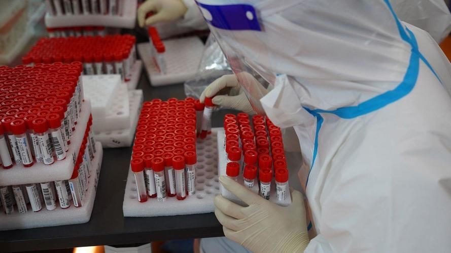 31省新增本土12例(31省新增本土9例),宜君疫情引关注_58226