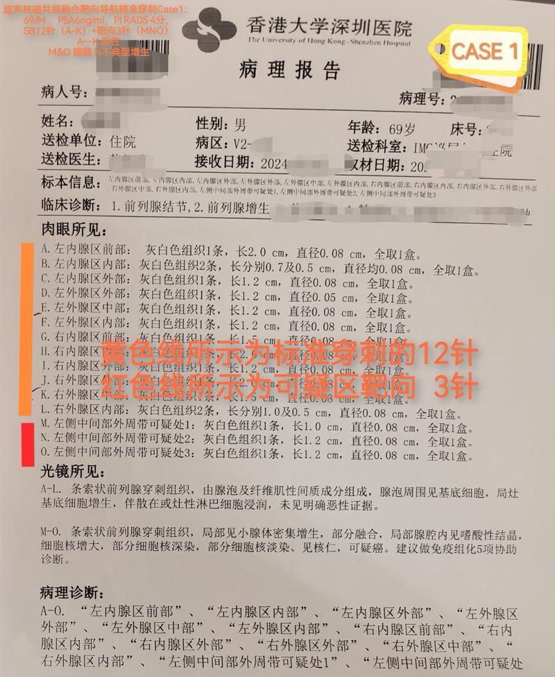 2022年11月25日安康新增确诊病例情况_26345
