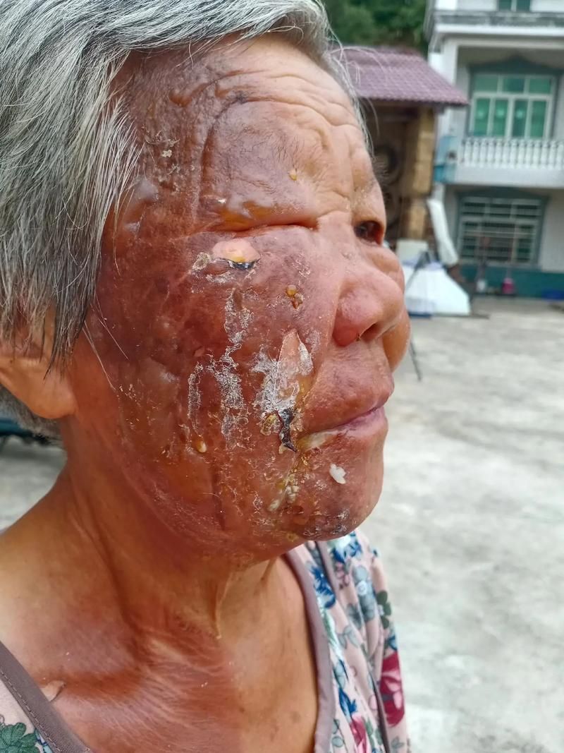 永寿县：黄土台塬屏障下的低感染样本