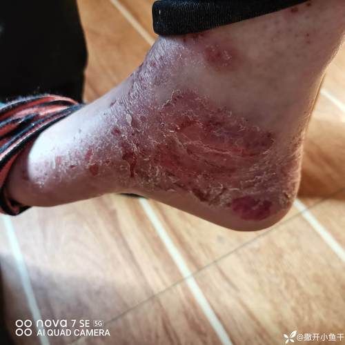 娄烦：吕梁山区屏障下的低感染样本