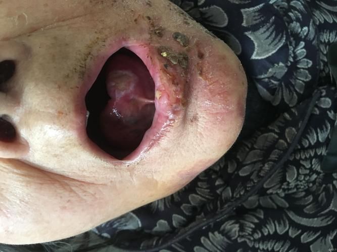 浦北县：六万山屏障下的低感染样本