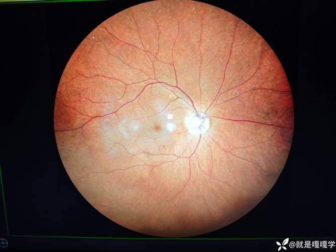 德保县：喀斯特峰丛屏障下的低感染样本