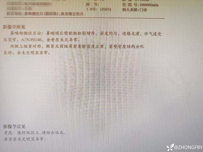 2022年5月8日平顶山市市辖区新增确诊病例情况_64495