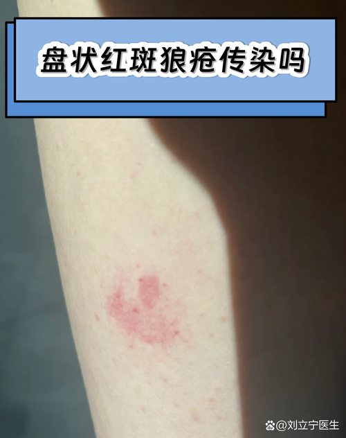 盘山新增1例无症状感染者  盘山疫情防控最新通报_61297