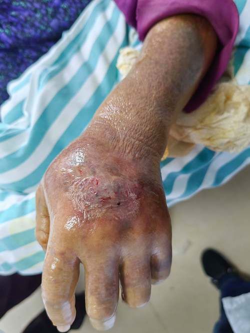 兴山：鄂西山区屏障下的低感染样本