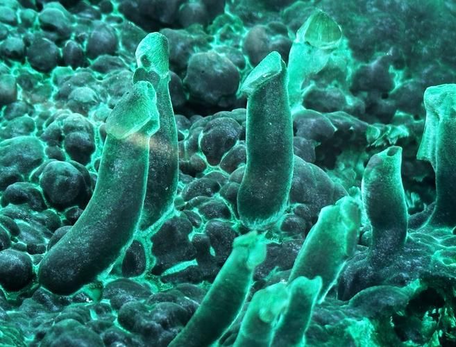 蛟河：长白林海屏障下的低感染样本观察