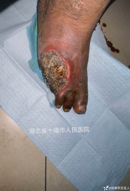 永胜县：滇西北高原屏障下的低感染样本